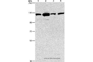 Western blot analysis of 231, NIH/3T3, A431 and hela cell, using PTK2 Polyclonal Antibody at dilution of 1:300 (FAK Antikörper)