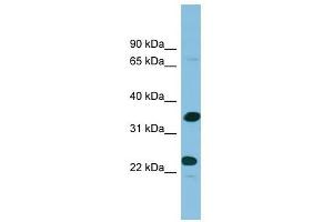 Prodynorphin antibody used at 1 ug/ml to detect target protein. (PDYN Antikörper  (Middle Region))