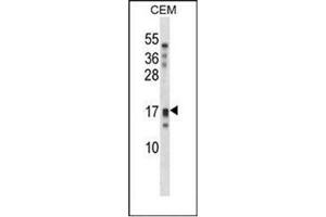 Western blot analysis of KLK15 / Kallikrein-15 Antibody (Center) in CEM cell line lysates (35ug/lane).