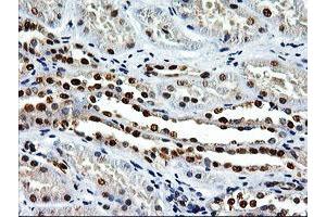 Image no. 2 for anti-EPM2A (Laforin) Interacting Protein 1 (EPM2AIP1) antibody (ABIN1498046) (EPM2AIP1 Antikörper)