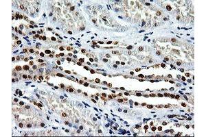 Image no. 2 for anti-EPM2A (Laforin) Interacting Protein 1 (EPM2AIP1) antibody (ABIN1498046)