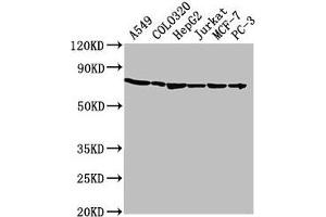 Western Blot Positive WB detected in: A549 whole cell lysate, COLO320 whole cell lysate, HepG2 whole cell lysate, Jurkat whole cell lysate, MCF-7 whole cell lysate, PC-3 whole cell lysate All lanes: HSPA1A antibody at 1:2000 Secondary Goat polyclonal to rabbit IgG at 1/50000 dilution Predicted band size: 71, 64 kDa Observed band size: 71 kDa (HSP70 1A Antikörper  (AA 291-641))