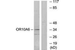 Western blot analysis of extracts from A549 cells, using OR10A6 Antibody. (OR10A6 Antikörper  (AA 241-290))
