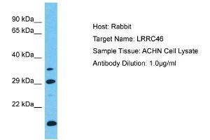 Host: Rabbit Target Name: LRRC46 Sample Type: ACHN Whole Cell lysates Antibody Dilution: 1. (LRRC46 Antikörper  (C-Term))