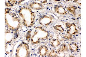 Anti- FXYZ1 Picoband antibody, IHC(P) IHC(P): Human Prostatic Cancer Tissue (FXYD1 Antikörper  (AA 21-92))