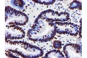 Image no. 5 for anti-Glutathione S-Transferase theta 2 (GSTT2) antibody (ABIN1498553) (GSTT2 Antikörper)