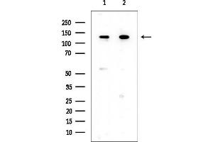 Western blot analysis of lysates from various samples, using HER2/ErbB2 Mouse Monoclonal Antibody at 1/1000 dilution.
