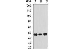 Western blot analysis of ADE2 expression in Jurkat (A), Raji (B), Hela (C) whole cell lysates. (PAICS Antikörper)