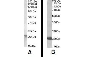 Western Blotting (WB) image for anti-GTPase NRas (NRAS) (Internal Region) antibody (ABIN2466026) (GTPase NRas Antikörper  (Internal Region))