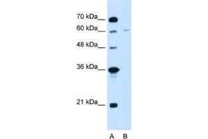 Western Blotting (WB) image for anti-Chromatin Assembly Factor 1, Subunit B (p60) (CHAF1B) antibody (ABIN2462905) (CHAF1B Antikörper)