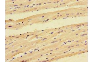 Immunohistochemistry of paraffin-embedded human heart tissue using ABIN7165923 at dilution of 1:100 (PPP1R12C Antikörper  (Regulatory Subunit 12C))