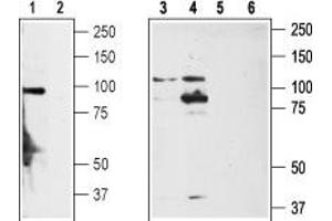 Western blot analysis of rat DRG (lanes 1,2), non-differentiated PC12 cells (lanes 3,5) and differentiated PC12 cells (lanes 4,6) lysates: - 1,3,4. (TRPA1 Antikörper  (1st Extracellular Loop))