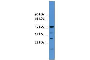 Western Blot showing SCAMP1 antibody used at a concentration of 1-2 ug/ml to detect its target protein. (SCAMP1 Antikörper  (Middle Region))