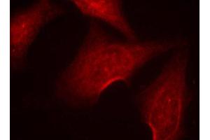 Immunofluorescence (IF) image for anti-Nuclear Factor-kB p65 (NFkBP65) (pSer311) antibody (ABIN1870583) (NF-kB p65 Antikörper  (pSer311))