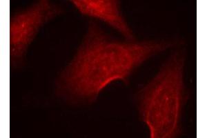 Immunofluorescence (IF) image for anti-Nuclear Factor-kB p65 (NFkBP65) (pSer311) antibody (ABIN1870583) (NF-kB p65 Antikörper  (pSer311))