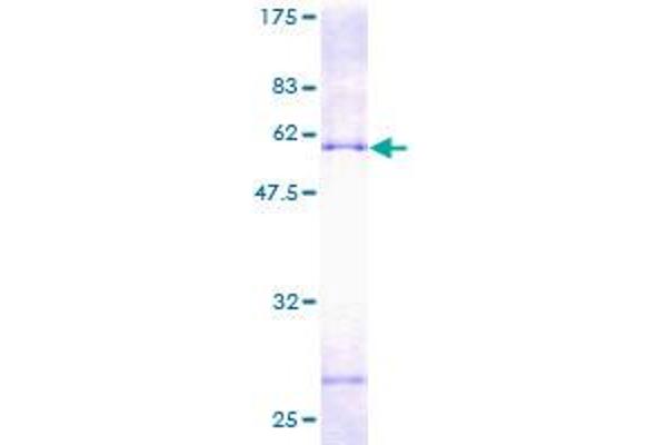 PECR Protein (AA 1-303) (GST tag)