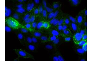 Human epithelial carcinoma cell line HEp-2 was stained with Mouse Anti-Human CD44-FITC followed by DAPI. (CD44 Antikörper  (FITC))