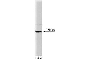 Western blot analysis of p27[Kip1] on HeLa cell lysate.