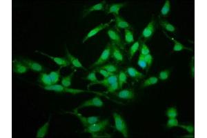Immunofluorescence staining of Hela cells with ABIN7142099 at 1:225, counter-stained with DAPI. (14-3-3 sigma/SFN Antikörper  (AA 1-248))