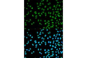 Immunofluorescence analysis of HeLa cells using CST8 antibody (ABIN5970566). (CST8 Antikörper)
