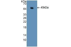 Detection of Recombinant ACTg2, Human using Polyclonal Antibody to Actin Gamma 2, Smooth Muscle (ACTg2)