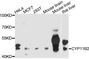Western blot analysis of extracts of various cells，using CYP11B2 antibody. (CYP11B2 Antikörper)