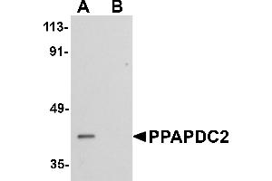 Western blot analysis of PPAPDC2 in Raji cell lysate with PPAPDC2 antibody at 1 µg/mL in (A) the absence and (B) the presence of blocking peptide. (PPAPDC2 Antikörper  (C-Term))