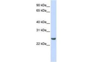 Image no. 1 for anti-NFKB Inhibitor Interacting Ras-Like 1 (NKIRAS1) (AA 36-85) antibody (ABIN6741314) (NKIRAS1 Antikörper  (AA 36-85))