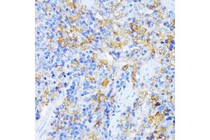 Immunohistochemistry (IHC) image for anti-Alanyl tRNA Synthetase (AARS) (AA 1-100) antibody (ABIN7265526)