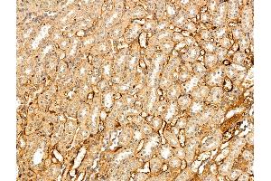 ABIN7094828 and ABIN7098879 at 1/100 staining Rat kidney tissue by IHC-P. (VLDLR Antikörper  (N-Term))