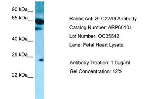 Western Blotting (WB) image for anti-Solute Carrier Family 22 (Organic Anion Transporter), Member 9 (SLC22A9) (C-Term) antibody (ABIN2790043) (SLC22A9 Antikörper  (C-Term))