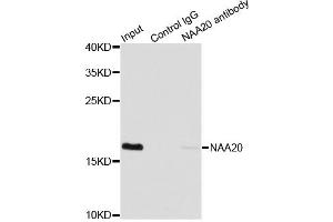 Immunoprecipitation analysis of 200ug extracts of MCF7 cells using 1ug NAA20 antibody. (NAT5 Antikörper)