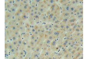 Detection of ADM in Human Liver Tissue using Polyclonal Antibody to Adrenomedullin (ADM) (Adrenomedullin Antikörper  (AA 22-147))