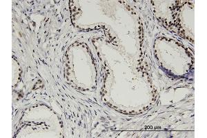 Immunostaining (ISt) image for anti-Aurora Kinase A (AURKA) (AA 1-110) antibody (ABIN563053)