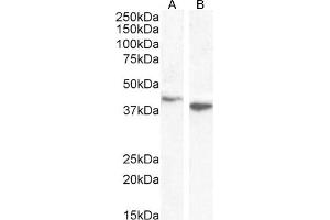 Western Blotting (WB) image for anti-SH3-Domain GRB2-Like Endophilin B1 (SH3GLB1) (C-Term) antibody (ABIN184621)