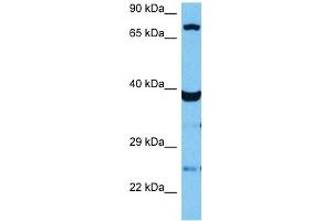 Host:  Mouse  Target Name:  TCF12  Sample Tissue:  Mouse Skeletal Muscle  Antibody Dilution:  1ug/ml (TCF12 Antikörper  (N-Term))