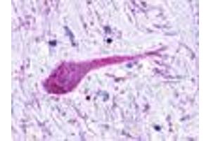 Anti-GPRC5B antibody IHC of human brain, neurons and glia. (GPRC5B Antikörper  (C-Term))