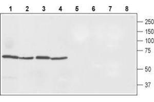 Western blot analysis of rat spleen (lanes 1 and 5), rat small intestine (lanes 2 and 6), rat liver (lanes 3 and 7) and mouse liver (lanes 4 and 8) lysates. (SLC40A1 Antikörper  (2nd Cytoplasmic Loop))