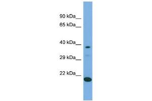 Host:  Rabbit  Target Name:  LIPT2  Sample Type:  293T Whole Cell lysates  Antibody Dilution:  1. (LIPT2 Antikörper  (C-Term))