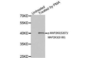 Western blot analysis of extracts of HL60 cell lines, using Phospho-MAP2K6-S207/MAP2K3-S189 antibody (ABIN5969926). (MAP2K6 Antikörper  (pSer207))