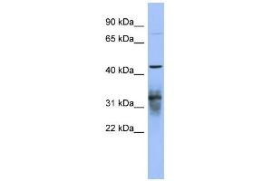 WB Suggested Anti-PABPC5 Antibody Titration:  0.