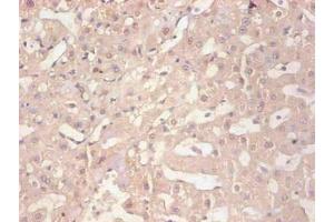 Immunohistochemical of paraffin-embedded human liver tissue using ABIN7152718 at dilution of 1:200 (FTL Antikörper)