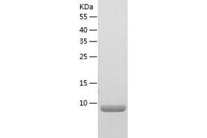 Western Blotting (WB) image for Chemokine (C-C Motif) Ligand 24 (CCL24) (AA 27-104) protein (His tag) (ABIN7122288)