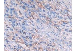 Immunohistochemistry (IHC) image for anti-Major Histocompatibility Complex, Class II, DR beta 1 (HLA-DRB1) (AA 30-266) antibody (ABIN7440764)