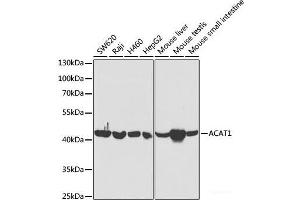 Western blot analysis of extracts of various cell lines using ACAT1 Polyclonal Antibody at dilution of 1:5000.