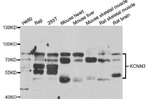 Western blot analysis of extracts of various cell lines, using KCNN3 antibody (ABIN6293039) at 1:1000 dilution.