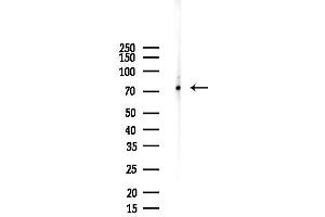Western blot analysis of lysates from COLO205 cells(LPS, 4h treatment), using GGA3 Antibody at 1/1000 dilution.