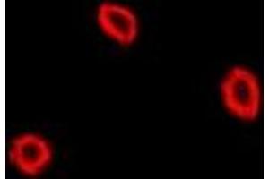 Immunofluorescent analysis of NPC2 staining in U2OS cells.