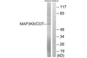 Western blot analysis of extracts from COLO cells, treated with Insulin (0. (MAP3K8 Antikörper  (Ser400))