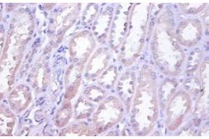 Immunohistochemistry of paraffin-embedded human kidney tissue using ABIN7173839 at dilution of 1:100 (TNFRSF1D (AA 58-208) Antikörper)